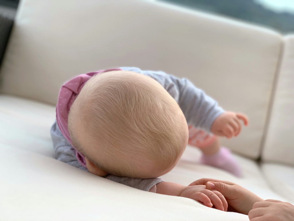 A baby's scalp free of cradle cap.